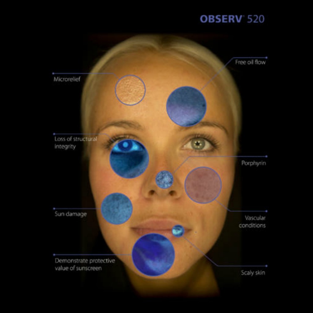 ASA-Observ-mebykatie