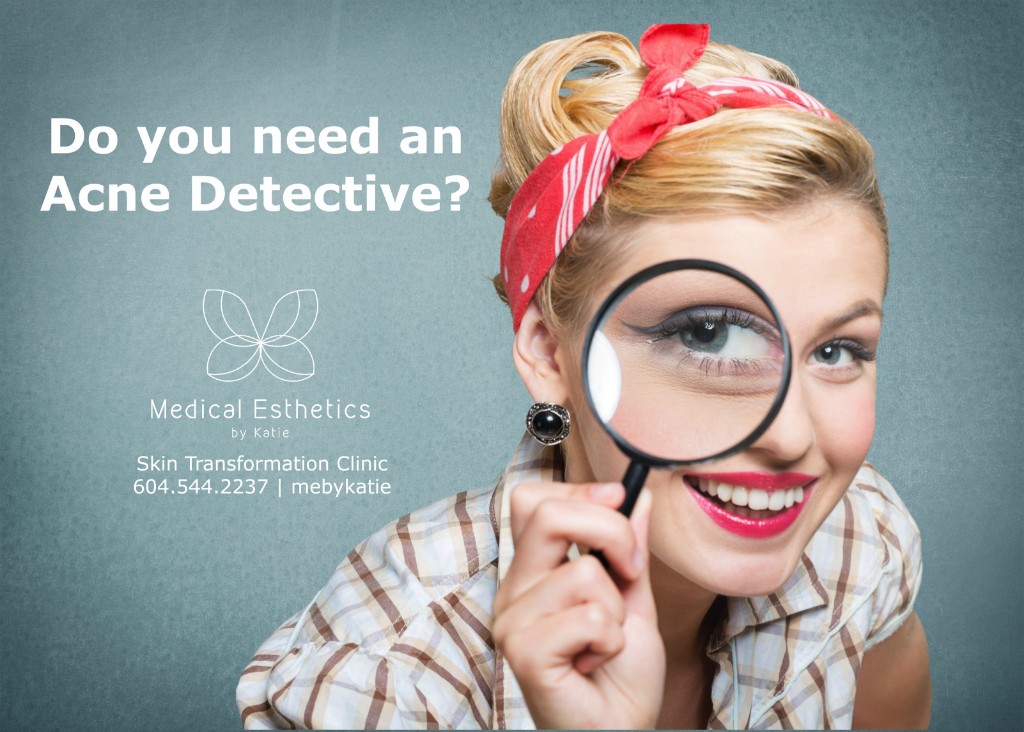 acne-detective-mebykatie